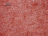 5 - Cellule corticali in visione superficiale
